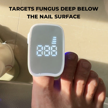LaseRx - Nail Fungus Remover Device